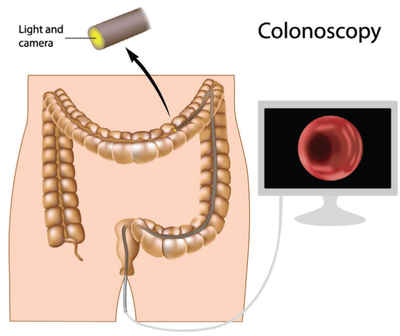 colorectal-cancer-anatomy