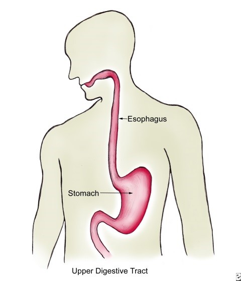 Esophageal